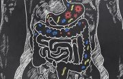 Probiotics for IBS